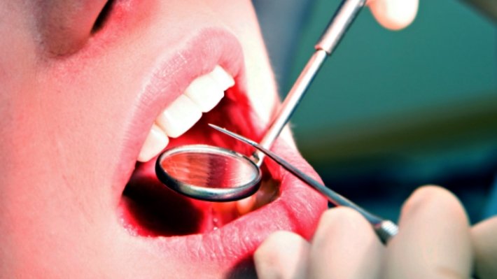 Методы лечения рака полости рта в Израиле
