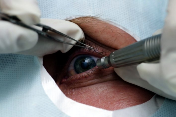 Методы лечения катаракты в Израиле